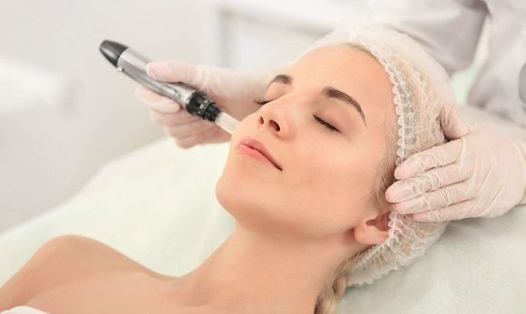 What is Microneedling? Understanding the Growing Trend in Skincare