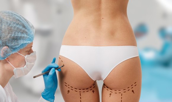 How Leg Liposculpture and Thread Lifts Elevate Appearance