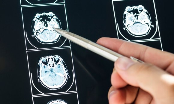 What You Should Know About Neurology and Nerve Conduction